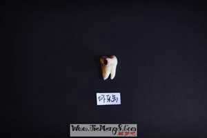 做梦梦到牙齿是黑色的-神算网(梦见牙齿是黑色怎么回事)