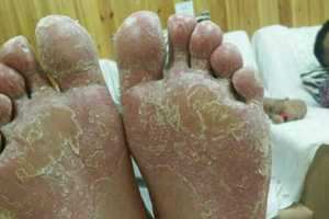 做梦梦到死人的脚(做梦梦到死人的脚是什么征兆)