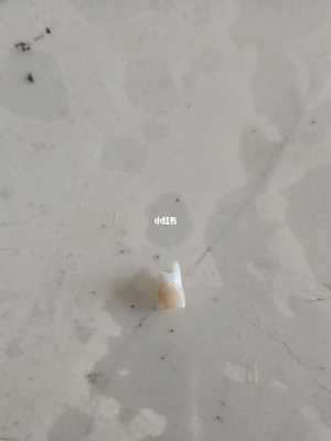 下牙掉了代表什么亲人(周公解梦下牙掉了代表什么亲人)
