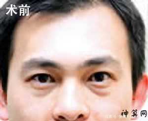 男人眼袋大的风水(男人眼袋大的面相)