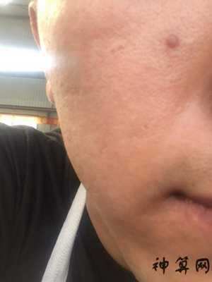 脸部猴子风水图片(脸上猴子的种类及图片)