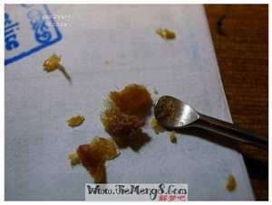 做梦梦见耳朵里长瘤了(做梦梦见耳朵里长瘤)