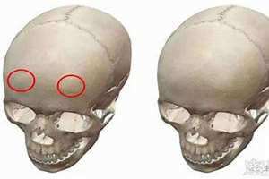 头骨后面有个凸起吉兆 头骨后面有个凸起一碰就疼