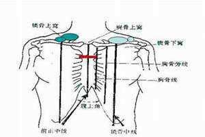 锁骨窝里面一根筋一按就疼 锁骨窝疼可能是什么病