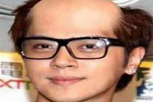 地中海头发是怎么形成的 地中海头发怎么治疗