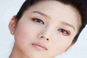 眼白有痣代表什么意思 眼白有痣面相