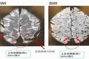 洞血怎么读 洞血是什么