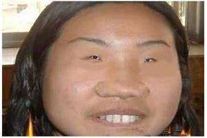 世界上脸最圆的人是谁 世界上脸最圆的人吉尼斯纪录是谁