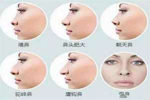 女人大鼻子好不好看(女人大鼻子好不好)