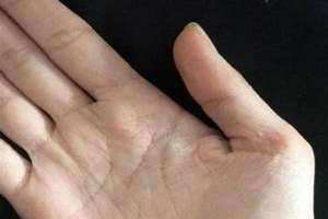 真正的贵人纹火星线 真正的贵人纹的,手掌纹