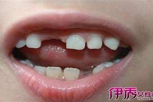 梦见牙齿掉了两颗是什么意思(梦见牙齿掉了两颗)