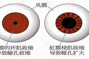 瞳孔小的原因(瞳孔小)