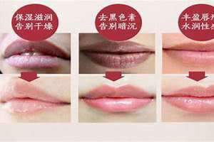 唇纹是什么原因造成的 唇纹是什么样的图片