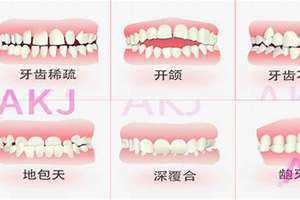 牙齿形状分为哪三类(牙齿形状)