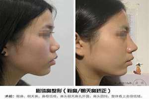 鼻孔朝天的男人是什么样的人 鼻孔朝天的图片