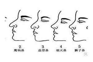 鼻子形状及图片大全 鼻子形状的种类