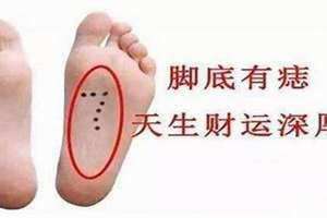 脚底长痣代表什么