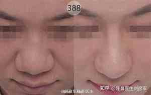 哪种鼻翼面相好看