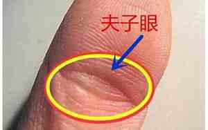 夫子眼里面有横纹的好不好