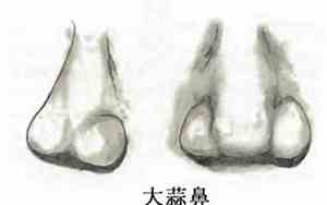 面相蒜头鼻怎么样