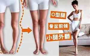 o型腿命运