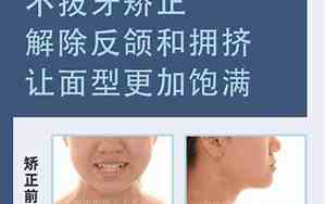牙齿中间凹陷两边尖图片