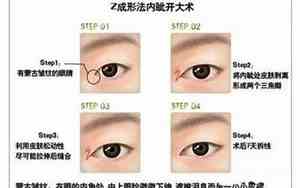 外眼角低于内眼角面相图片