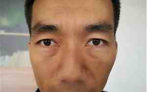 右眼大左眼小面相怎样看