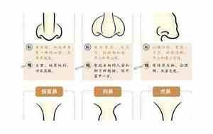 翘鼻子的人命运