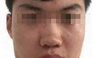 人死前变黑