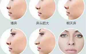 女人鼻子小什么面相最好图片