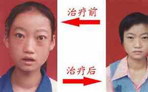 面容消瘦的面相女生