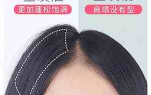 头发贴头皮的面相图片
