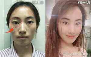 眼眶凹陷的女人晚年面相