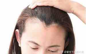 发际线不对称的女人面相