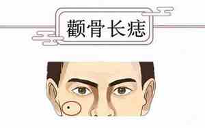 男左颧骨有黑痣好吗