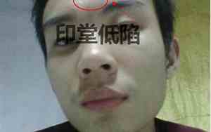 面相凶的男人命运怎么样