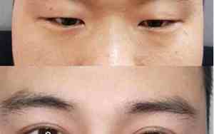 双眼小男人面相图片