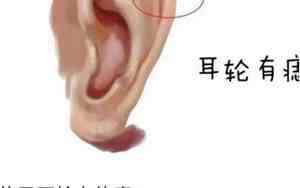 中耳轮有痣