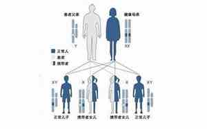 各种遗传病的面相图片