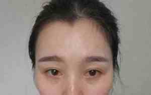 前不见耳,后不见腮,面相学