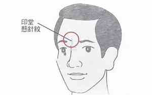 嘴角边有竖纹面相图片