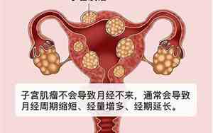 子宫肌瘤忌口吗不能吃什么