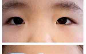 女人右眼斜视面相