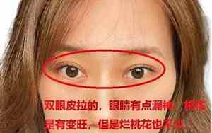 中年鼻头变大面相好不好